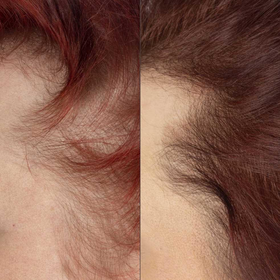 Close up of before and after image of red haired woman with thin hair and hair growth results over 16 weeks. 
